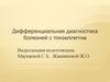 Дифференциальная диагностика болезней с тонзиллитом