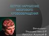 Острое нарушение мозгового кровообращения