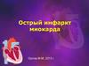 Острый инфаркт миокарда