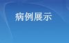 病例展示