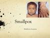 Smallpox