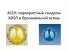 ACOS: перекрестный синдром ХОБЛ и бронхиальной астмы