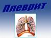 Плеврит. Классификация