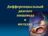 Дифференциальный диагноз пищевода и желудка