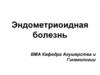 Эндометриоидная болезнь