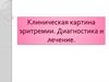Клиническая картина эритремии. Диагностика и лечение