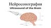 Нейросонография. Показания к НСГ