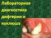 Лабораторная диагностика дифтерии и коклюша