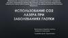 Использование СО2 лазера при заболеваниях глотки