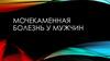 Мочекаменная болезнь у мужчин