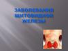 Заболевания щитовидной железы