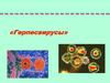 Герпетическая инфекция