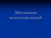 Заболевания челюстных костей