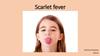 Scarlet fever