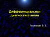 Дифференциальная диагностика ангин