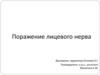 Поражение лицевого нерва