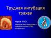 Трудная интубация трахеи