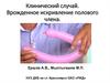 Клинический случай. Врожденное искривление полового члена