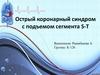 Острый коронарный синдром с подъемом сегмента S-T