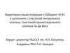 Видеотрансляция операции «Лабиринт III В» в сочетании с пластикой митрального клапана, пластикой трикуспидального клапана