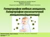 Гипертрофия небных миндалин. Гипертрофия носоглоточной миндалины (аденоиды)