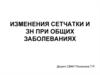 Изменения сетчатки и ЗН при общих заболеваниях