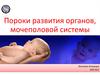 Пороки развития органов мочеполовой системы
