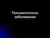 Гельминтозные заболевания