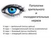 Патологии зрительного и глазодвигательных нервов