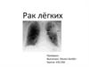 Рак лёгких