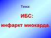 ИБС: инфаркт миокарда