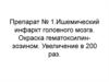 Некроз. Смерть, признаки смерти. Посмертные изменения