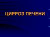 Цирроз печени