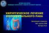 Хирургическое лечения колоректального рака