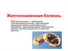 Желчнокаменная болезнь