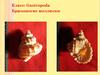 Класс: Gastropoda. Брюхоногие моллюски