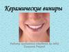 Керамические виниры