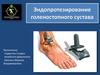 Эндопротезирование голеностопного сустава