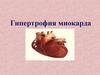 Гипертрофия миокарда