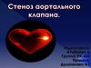 Стеноз аортального клапана