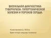 Визуальная диагностика туберкулеза, гипертонической болезни и пороков сердца