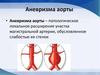Аневризма аорты
