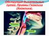 Обструкция дыхательных путей. Приемы Геймлиха (Хеймлиха)