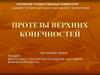 Протезы верхних конечностей