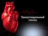 Трикуспидальный стеноз