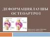 Деформациялауші остеоартроз