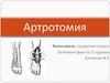 Операция вскрытия или обнажения сустава - артротомия