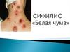 Сифилис («Белая чума»)