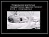 Ультразвуковая диагностика геморрагических нарушений головного мозга у новорожденных