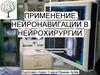 Применение нейронавигации в нейрохирургии